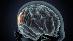 Yksityiskohtainen selvitys siitä, mitä seurauksia toistuvalla unenpuutteella on.